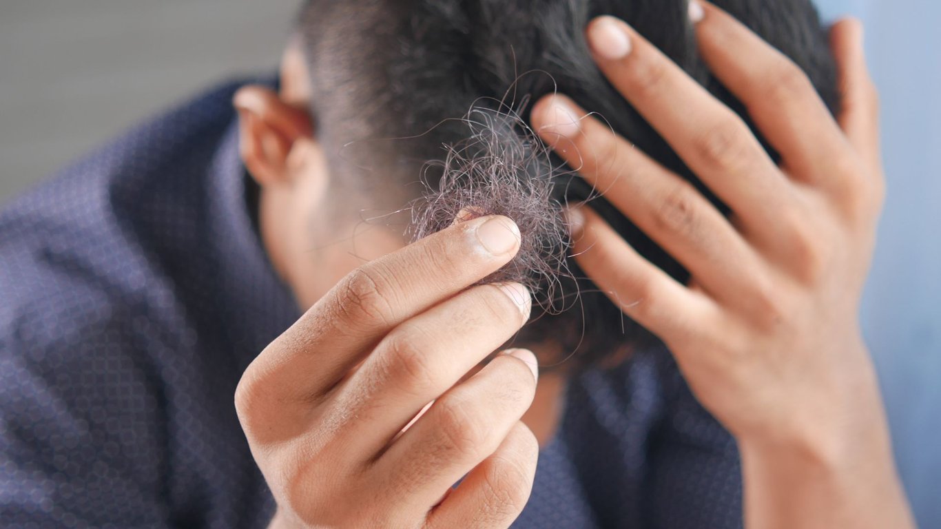 does vaping cause hair loss