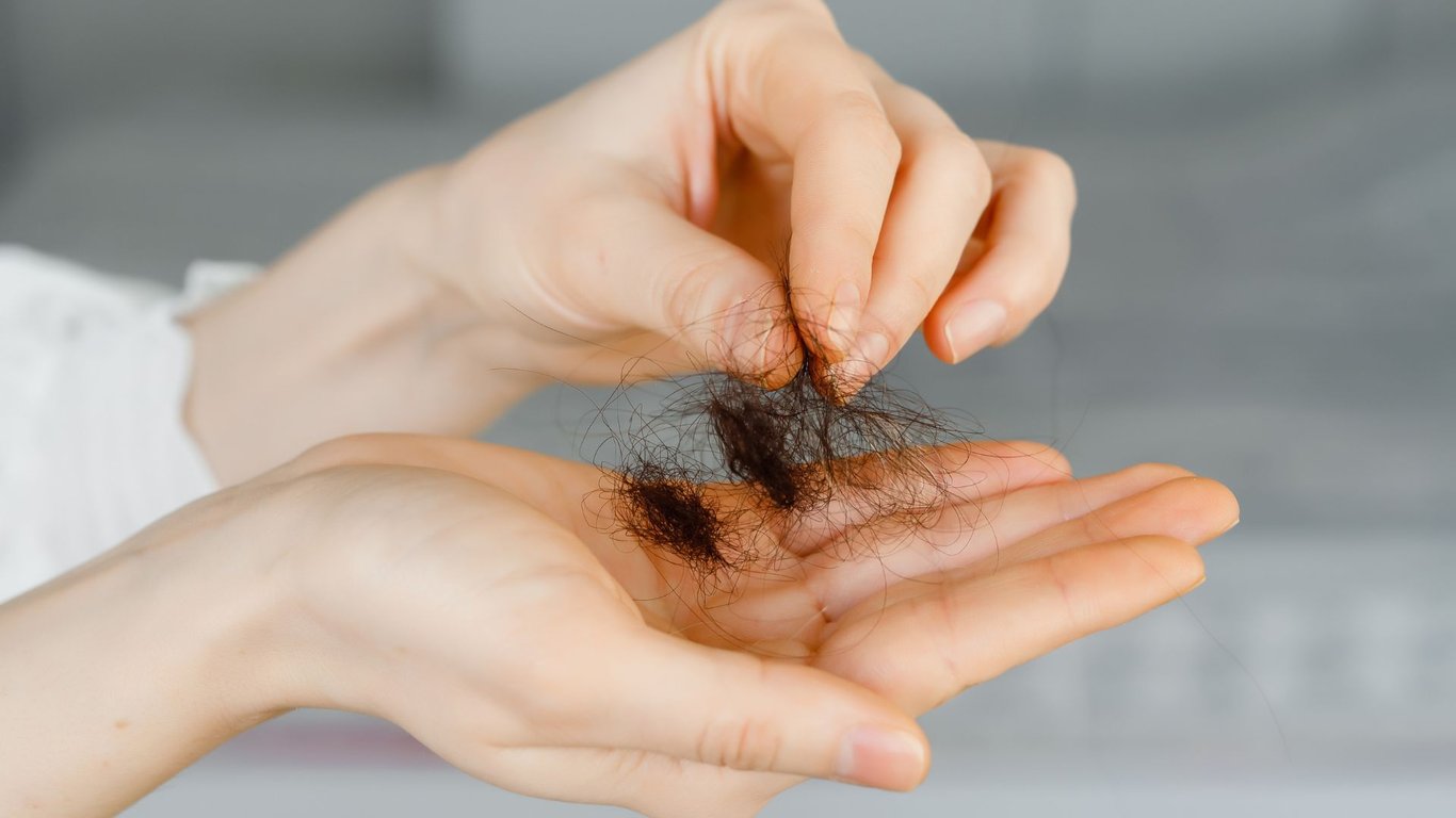 does vaping cause hair loss